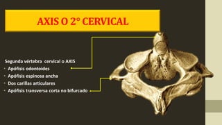 Segunda vértebra cervical o AXIS
• Apófisis odontoides
• Apófisis espinosa ancha
• Dos carillas articulares
• Apófisis transversa corta no bifurcado
AXIS O 2° CERVICAL
 