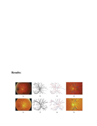 IEEE 2014 MATLAB IMAGE PROCESSING PROJECTS An automatic graph based ...