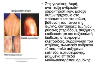 • Στις γυναίκες: Ακμή,
ανάπτυξη ανδρικών
χαρακτηριστικών, μεταξύ
αυτών τριχοφυΐα στο
πρόσωπο και στο σώμα,
βάθυνση του τόνου της
φωνής, διαταραχές εμμήνου
ρύσεως (περιόδου), αυξημένη
επιθετικότητα και σεξουαλική
διάθεση, υπερτροφία
κλειτορίδας, συρρίκνωση του
στήθους, αλωπεκία ανδρικού
τύπου, πολύ αυξημένα
επίπεδα τεστοστερόνης,
μειωμένα επίπεδα
ωοθυλακιοτρόπου ορμόνης.
 