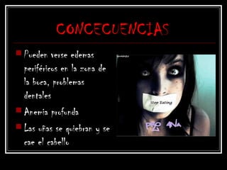 CONCECUENCIAS
 Pueden verse edemas
periféricos en la zona de
la boca, problemas
dentales
 Anemia profunda
 Las uñas se quiebran y se
cae el cabello
 