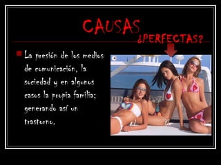 CAUSAS
 La presión de los medios
de comunicación, la
sociedad y en algunos
casos la propia familia;
generando así un
trastorno.
¿PERFECTAS?
 