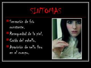 SINTOMAS
Sensación de frío
constante.
Resequedad de la piel.
Caída del cabello.
Aparición de vello fino
en el cuerpo.
 