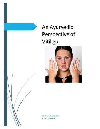 An Ayurvedic
Perspective of
Vitiligo
Dr. Vikram Chauhan
PLANET AYURVEDA
 