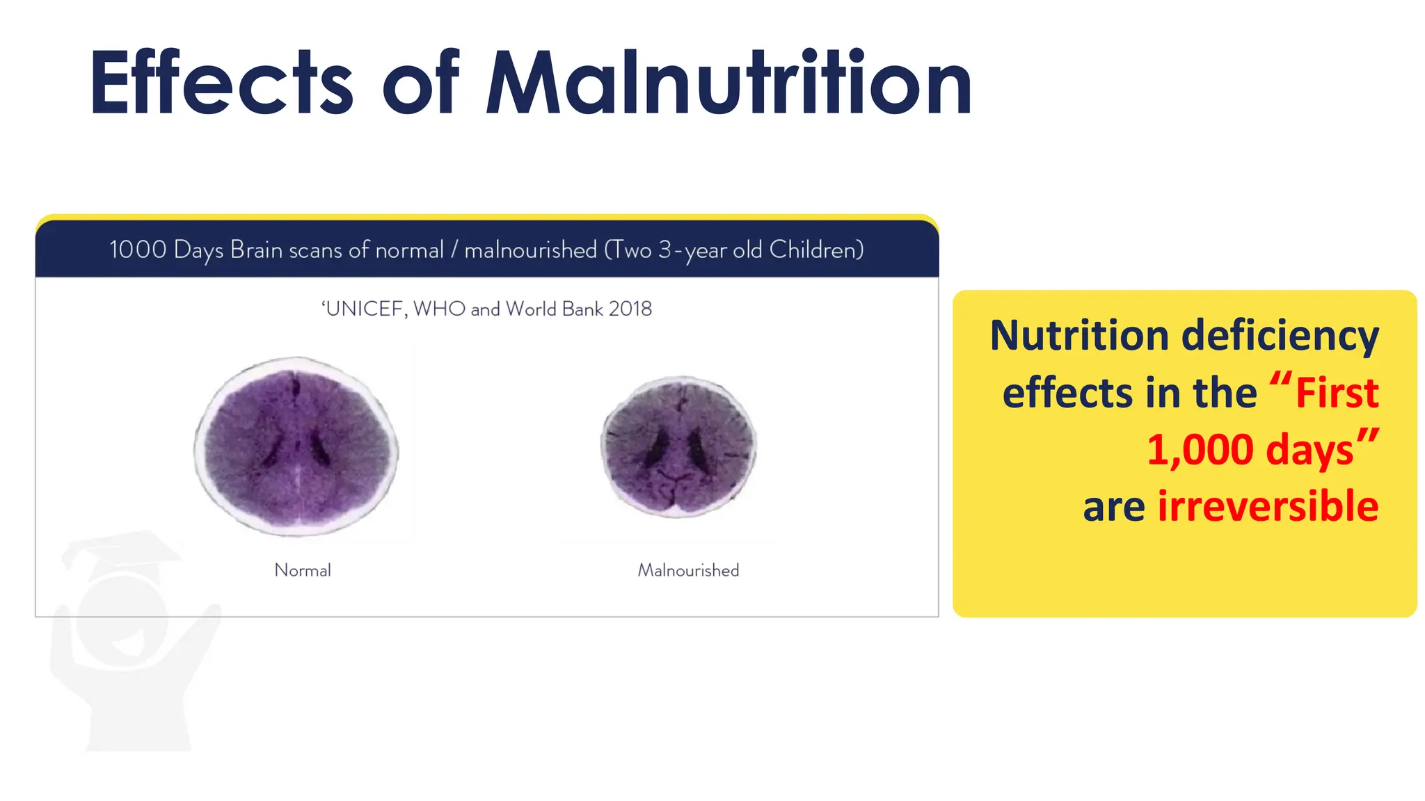 Effects of Malnutrition
Nutrition deficiency
effects in the “First
1,000 days”
are irreversible
 