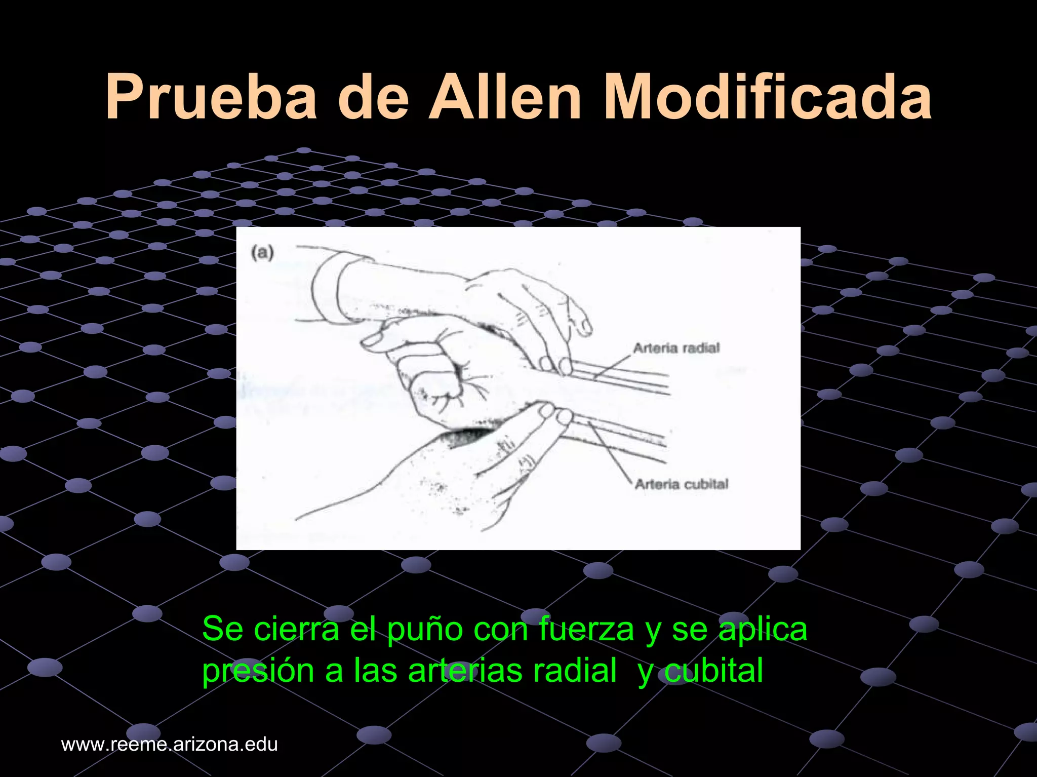 An%c3%a1lisis%20de%20 gases%20arteriales higado%20ri%c3%b1on%20diabetes ...