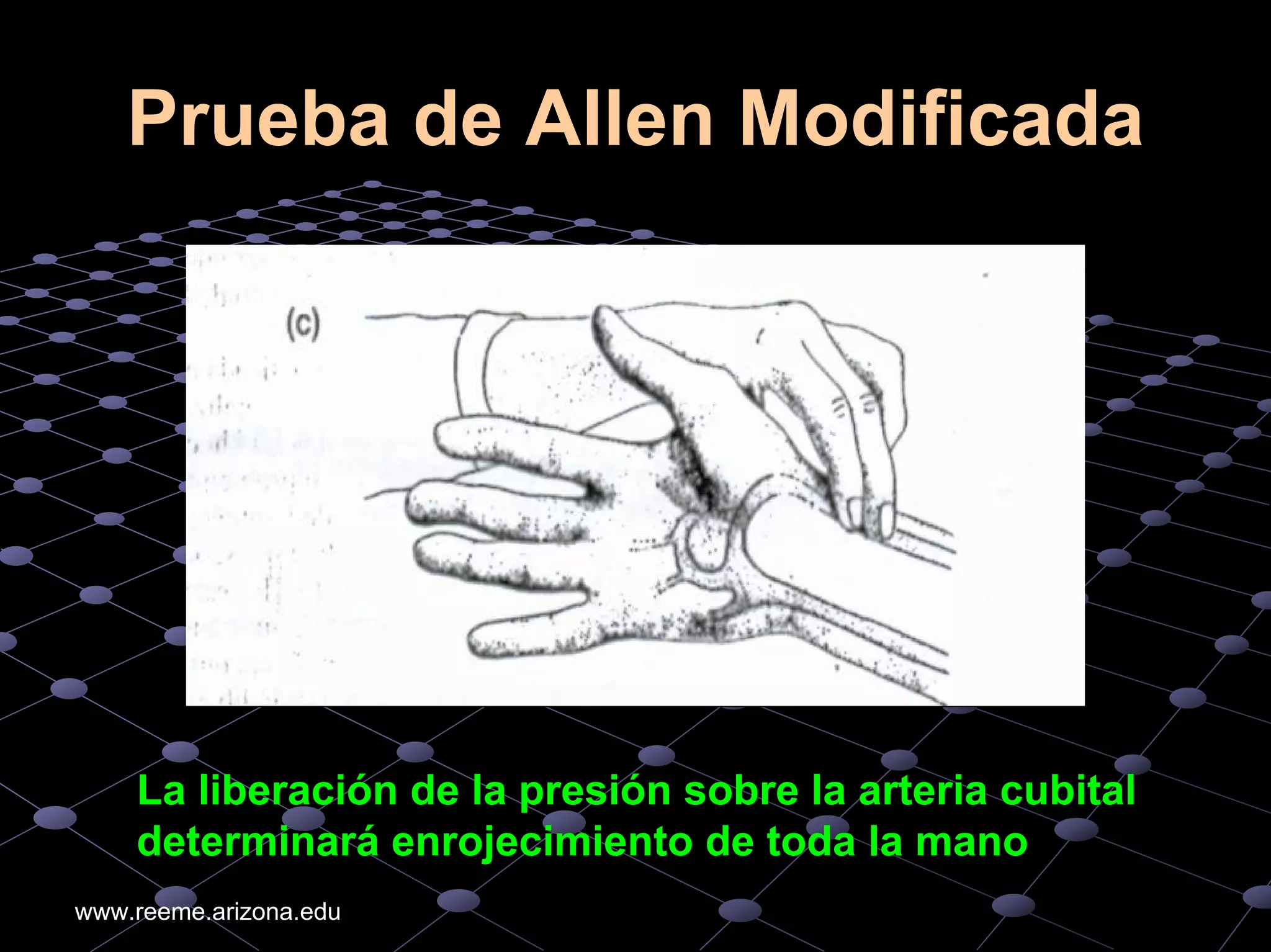 An%c3%a1lisis%20de%20 gases%20arteriales higado%20ri%c3%b1on%20diabetes ...