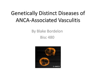 Genetically Distinct Diseases of
ANCA-Associated Vasculitis
By Blake Bordelon
Bisc 480

 