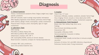 ANCA associated vasculitis.pdf////////// | PDF