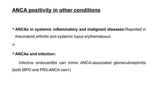 Duta Anca ANCA POSITIVE VASCULITIS.pptx vasculitis | PPTX
