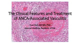 The Clinical Features and Treatment
of ANCA-Associated Vasculitis
Evan Nair-Gill MD, PhD
Internal Medicine Resident, UTSW
 
