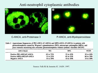 Pulse vs. Daily Oral Cyclophosphamide for Induction of Remission in ...