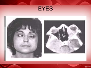 EYES
 