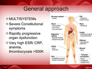 General approach
MULTISYSTEMs
Severe Constitutional
symptoms
Rapidly progressive
organ dysfunction
Very high ESR/ CRP,
anemia,
thrombocyosis >500K
 