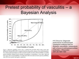 Pretest probability of vasculitis – a
Bayesian Analysis
H K Choi,et al. Diagnostic
performance of antineutrophil
cytoplasmic antibody tests for
idiopathic vasculitides: metaanalysis
with a focus on antimyeloperoxidase
antibodies. J Rheumatol
2001;28;1584-1590
 