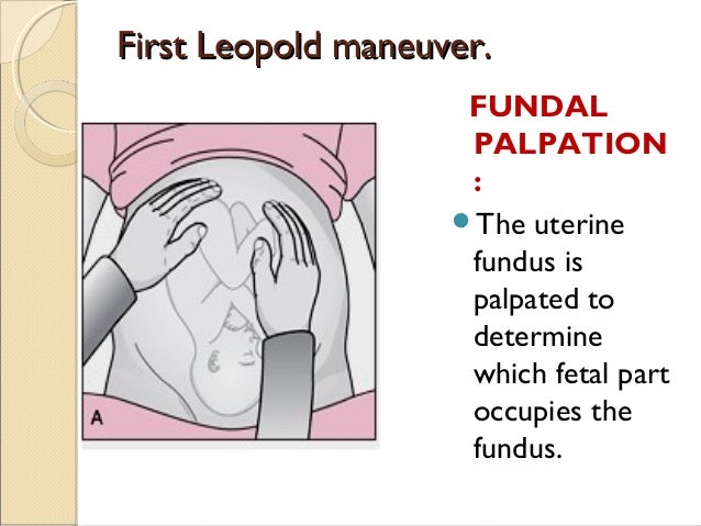 leopold maneuver