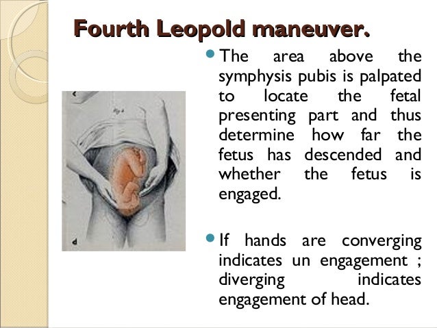 leopold maneuver