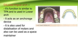 Sources of Anchorage | PPTX