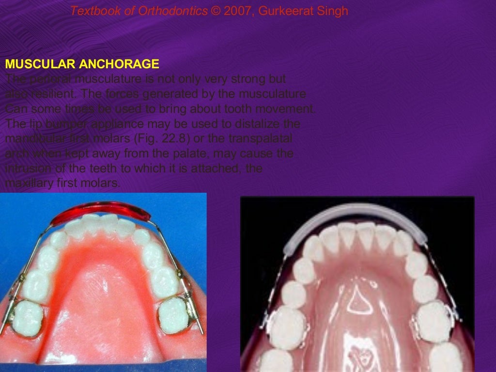 Anchorage in orthodontics