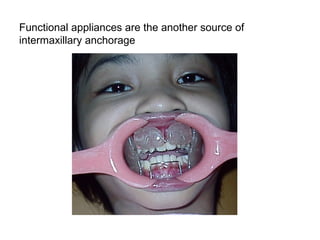 Functional appliances are the another source of
intermaxillary anchorage
 