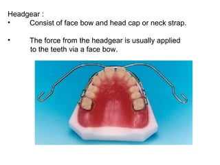 Headgear :
• Consist of face bow and head cap or neck strap.
• The force from the headgear is usually applied
to the teeth via a face bow.
 