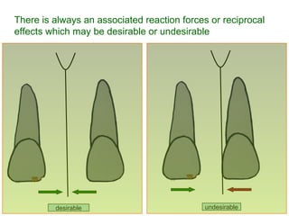 There is always an associated reaction forces or reciprocal
effects which may be desirable or undesirable
desirable undesirable
 