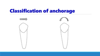 Classification of anchorage
 