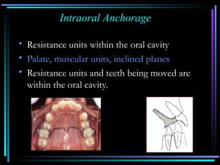 Lecture on anchorage which will help people undertanding in ...