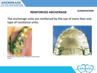 Anchorage and its type and variations | PPT