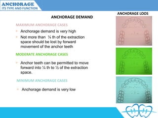 Anchorage and its type and variations | PPT