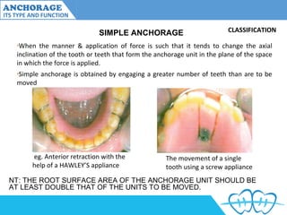 Anchorage and its type and variations | PPT