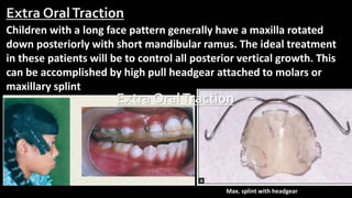 Anchorage for removable orthodontic appliances | PPTX
