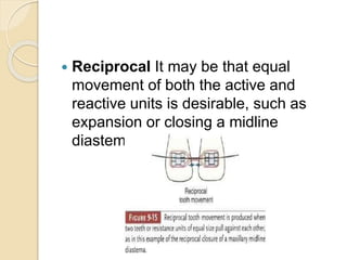 Reciprocal Tooth Anchorage in orthodontics- Dr Lubna Abu Alrub | PPTX