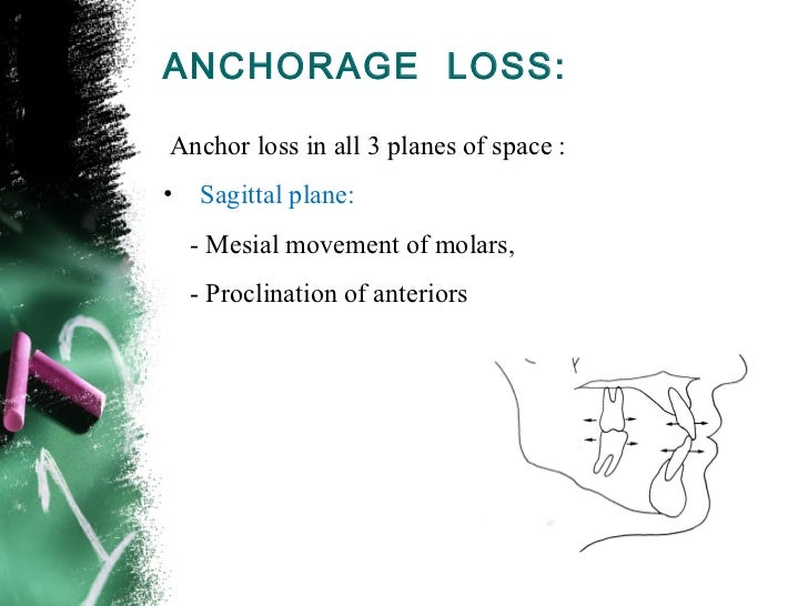 Anchorage in orthodontics