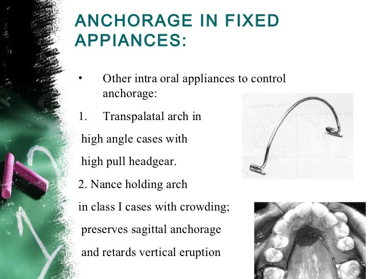 Anchorage in orthodontics