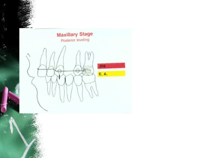 Anchorage in orthodontics
