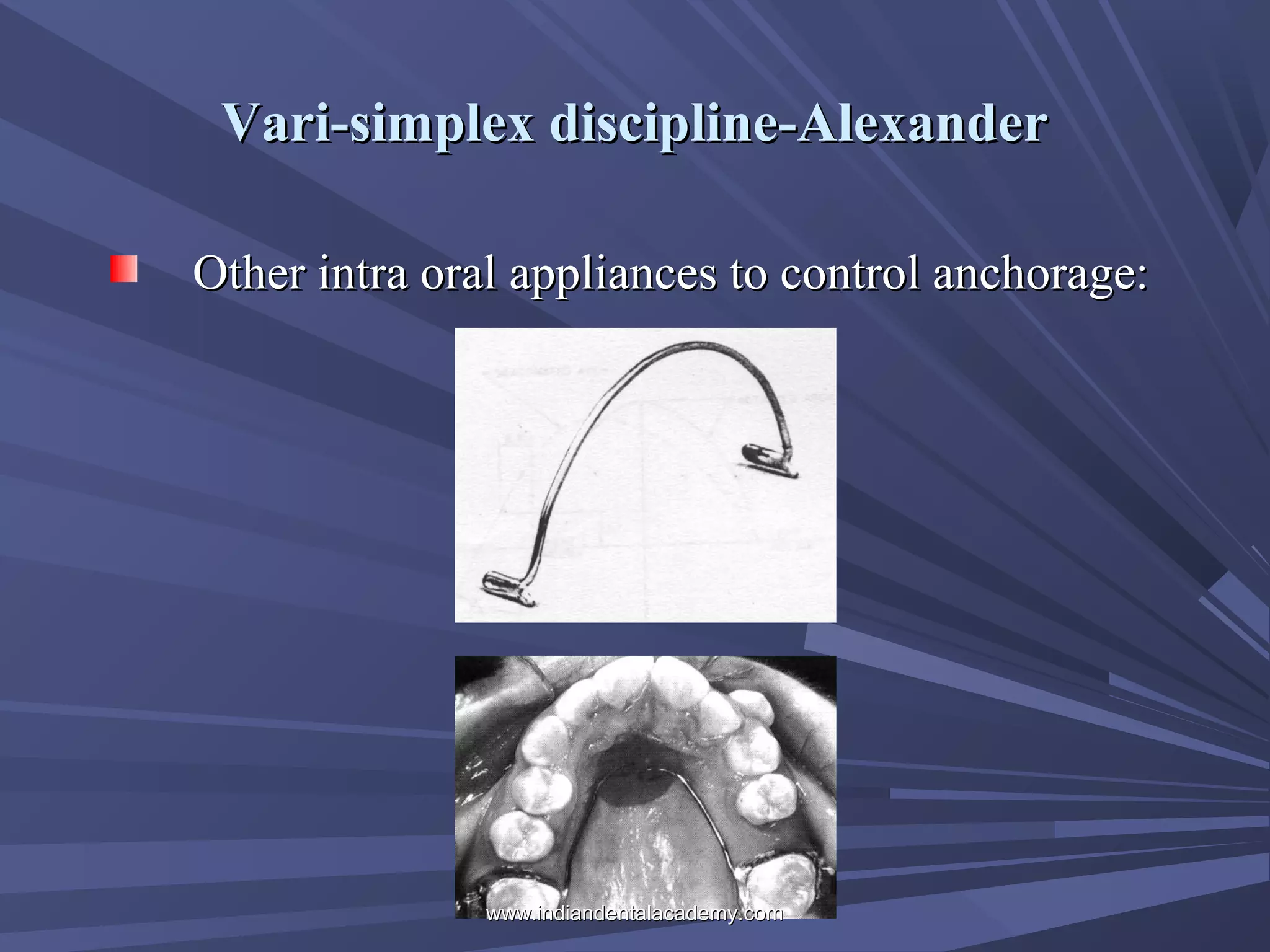 Vari-simplex discipline-Alexander
Other intra oral appliances to control anchorage:

www.indiandentalacademy.com

 