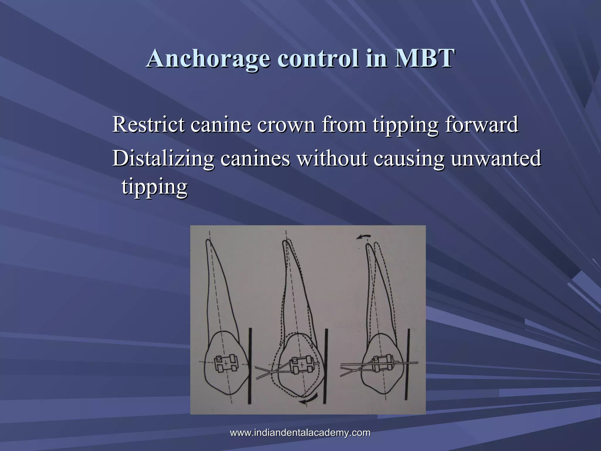 Anchorage control in MBT
Restrict canine crown from tipping forward
Distalizing canines without causing unwanted
tipping

www.indiandentalacademy.com

 