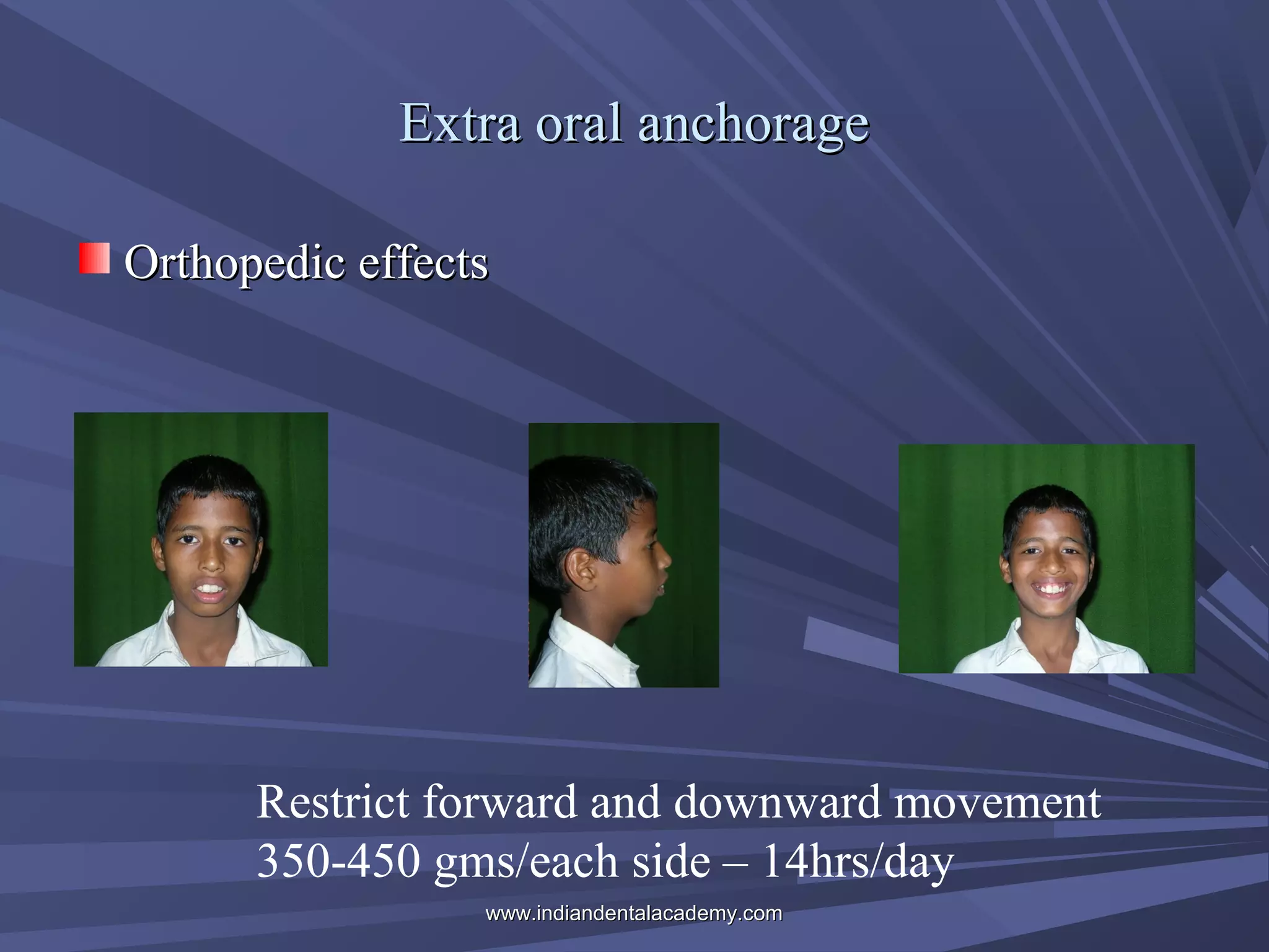 Extra oral anchorage
Orthopedic effects

Restrict forward and downward movement
350-450 gms/each side – 14hrs/day
www.indiandentalacademy.com

 
