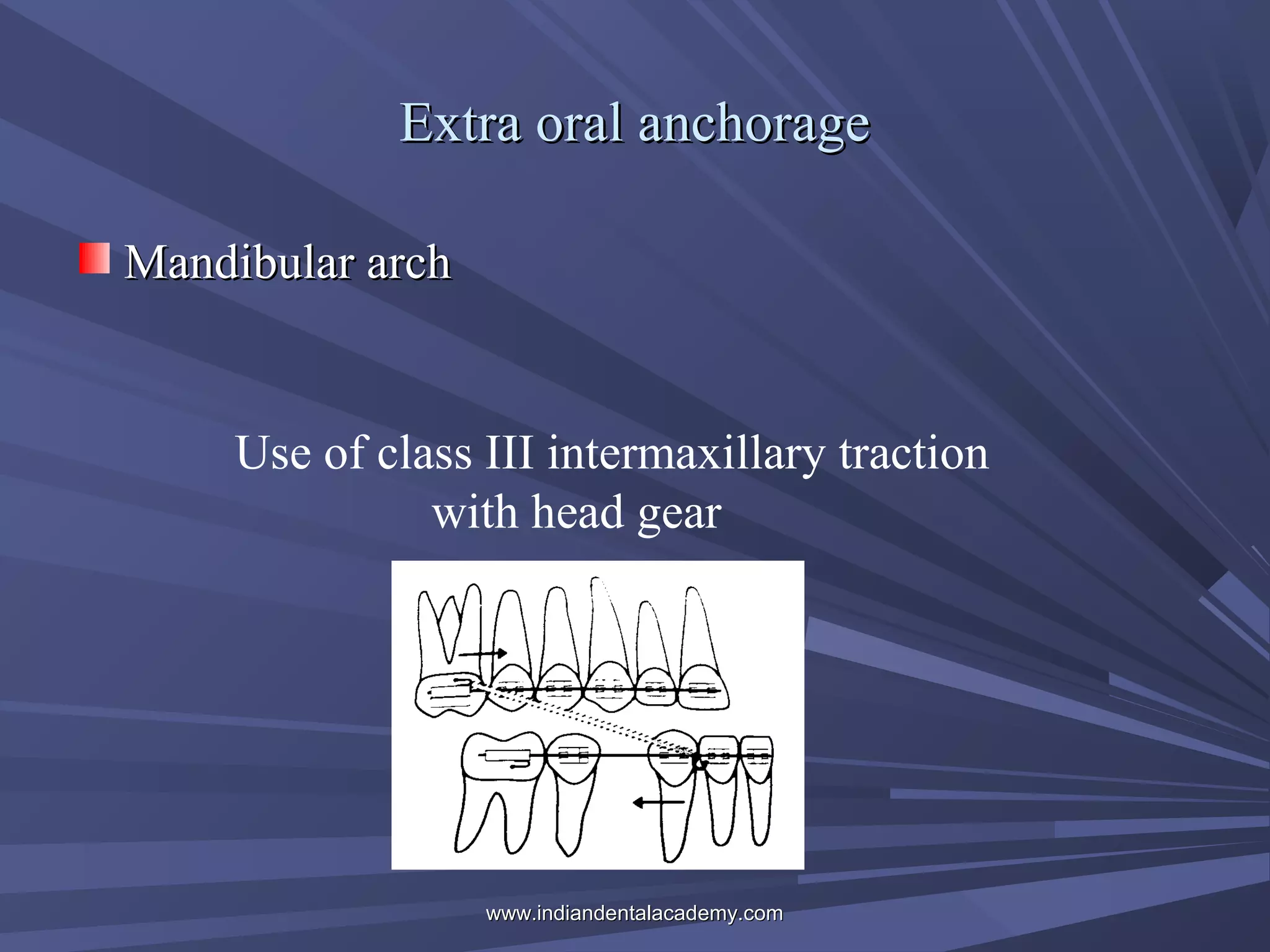 Extra oral anchorage
Mandibular arch

Use of class III intermaxillary traction
with head gear

www.indiandentalacademy.com

 