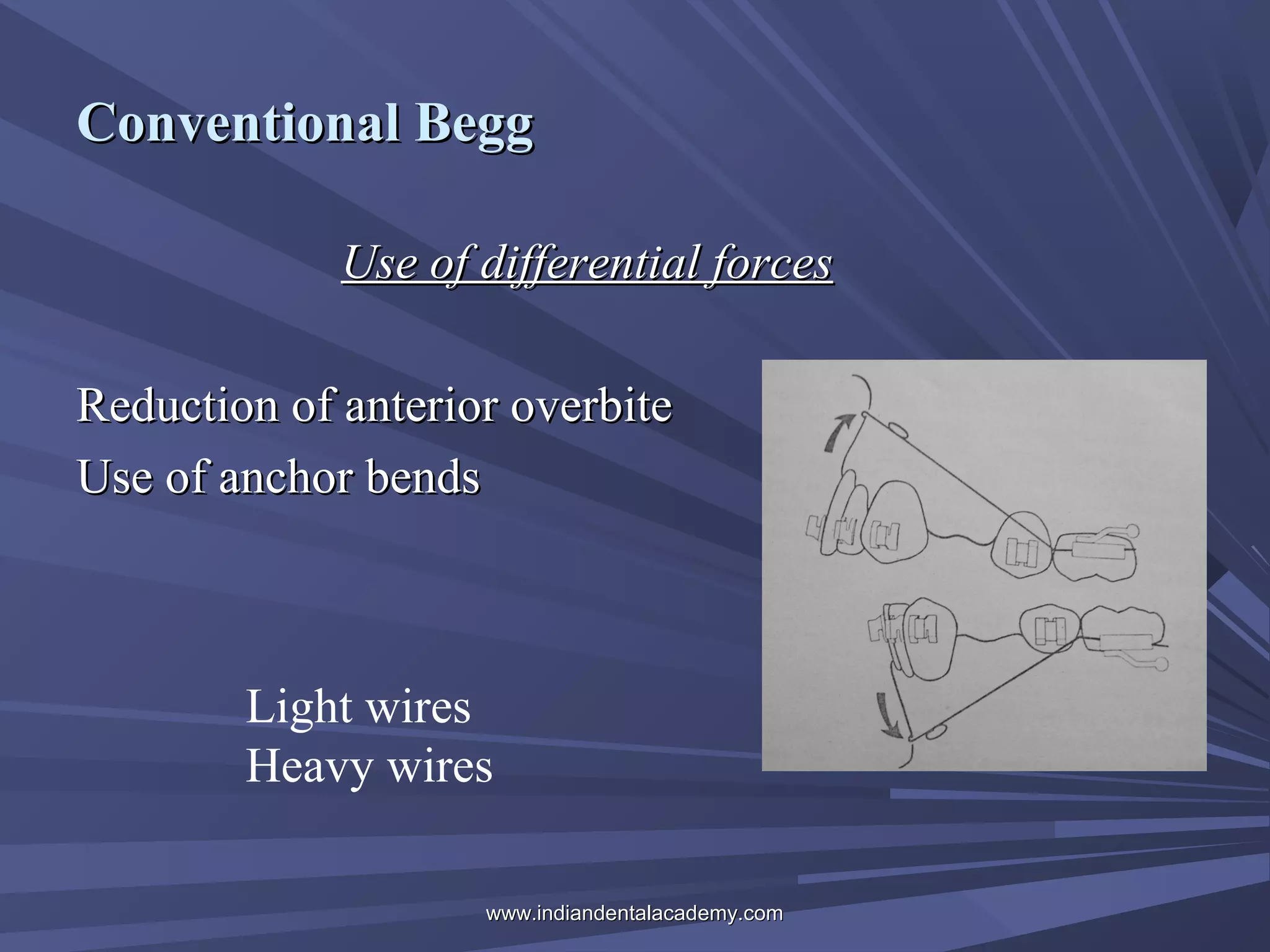 Conventional Begg
Use of differential forces
Reduction of anterior overbite
Use of anchor bends

Light wires
Heavy wires
www.indiandentalacademy.com

 
