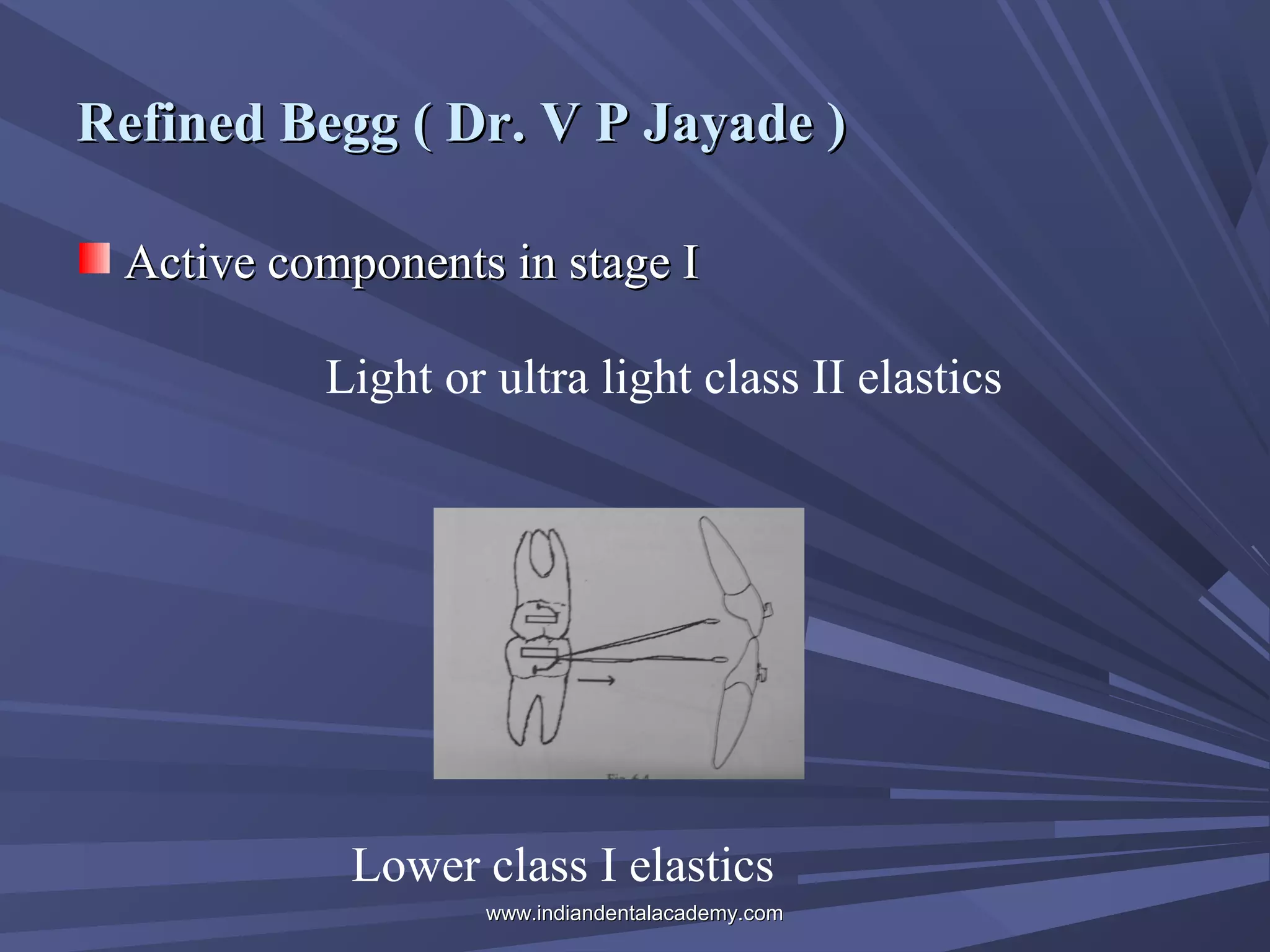 Refined Begg ( Dr. V P Jayade )
Active components in stage I
Light or ultra light class II elastics

Lower class I elastics
www.indiandentalacademy.com

 