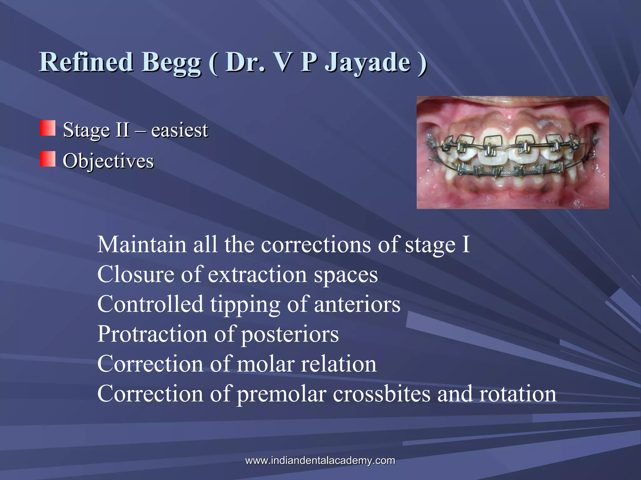 Refined Begg ( Dr. V P Jayade )
Stage II – easiest
Objectives

Maintain all the corrections of stage I
Closure of extraction spaces
Controlled tipping of anteriors
Protraction of posteriors
Correction of molar relation
Correction of premolar crossbites and rotation
www.indiandentalacademy.com

 