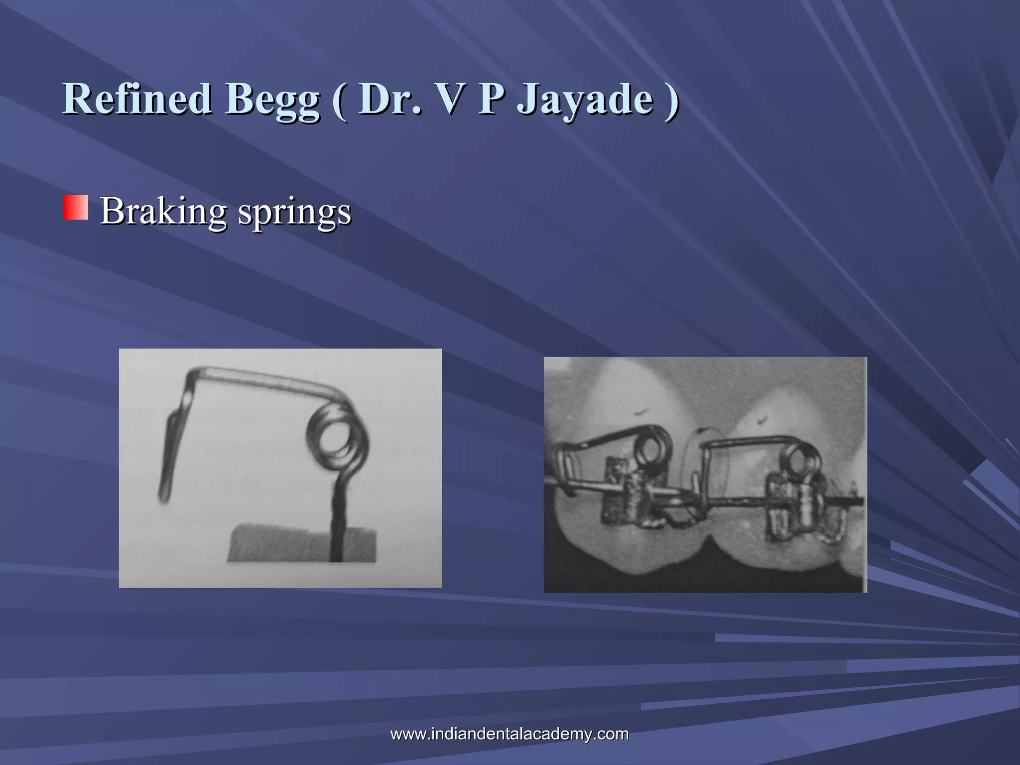 Refined Begg ( Dr. V P Jayade )
Braking springs

www.indiandentalacademy.com

 