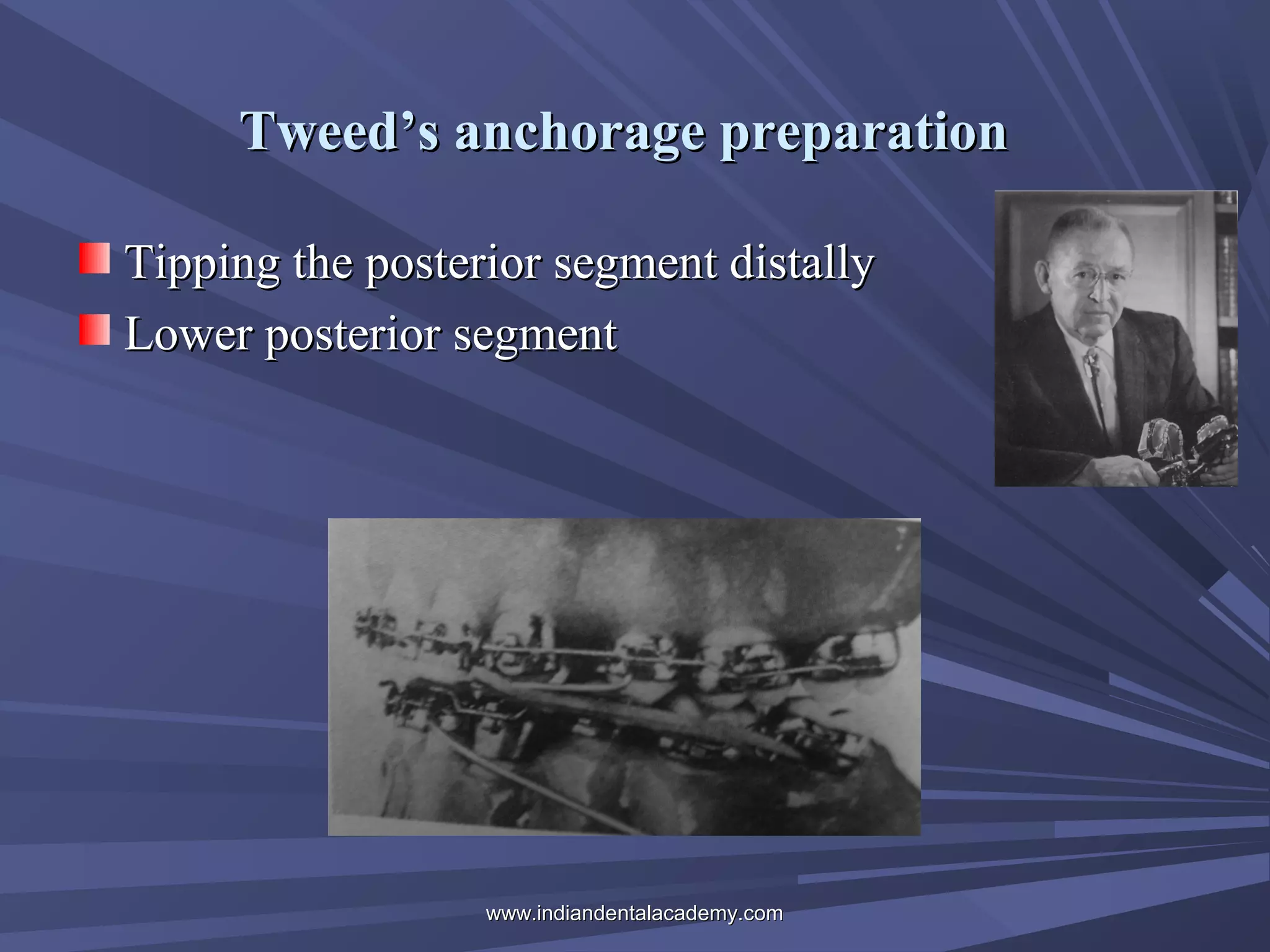 Tweed’s anchorage preparation
Tipping the posterior segment distally
Lower posterior segment

www.indiandentalacademy.com

 