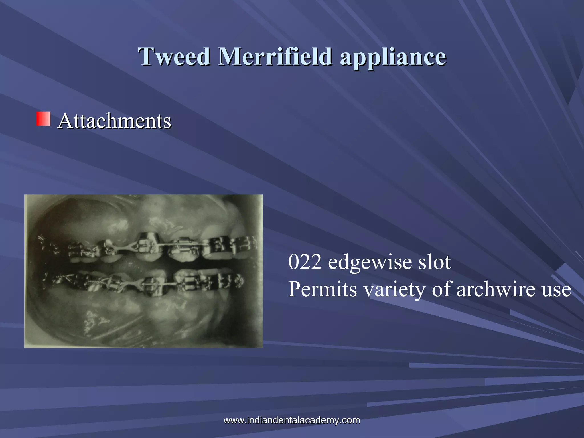 Tweed Merrifield appliance
Attachments

022 edgewise slot
Permits variety of archwire use

www.indiandentalacademy.com

 