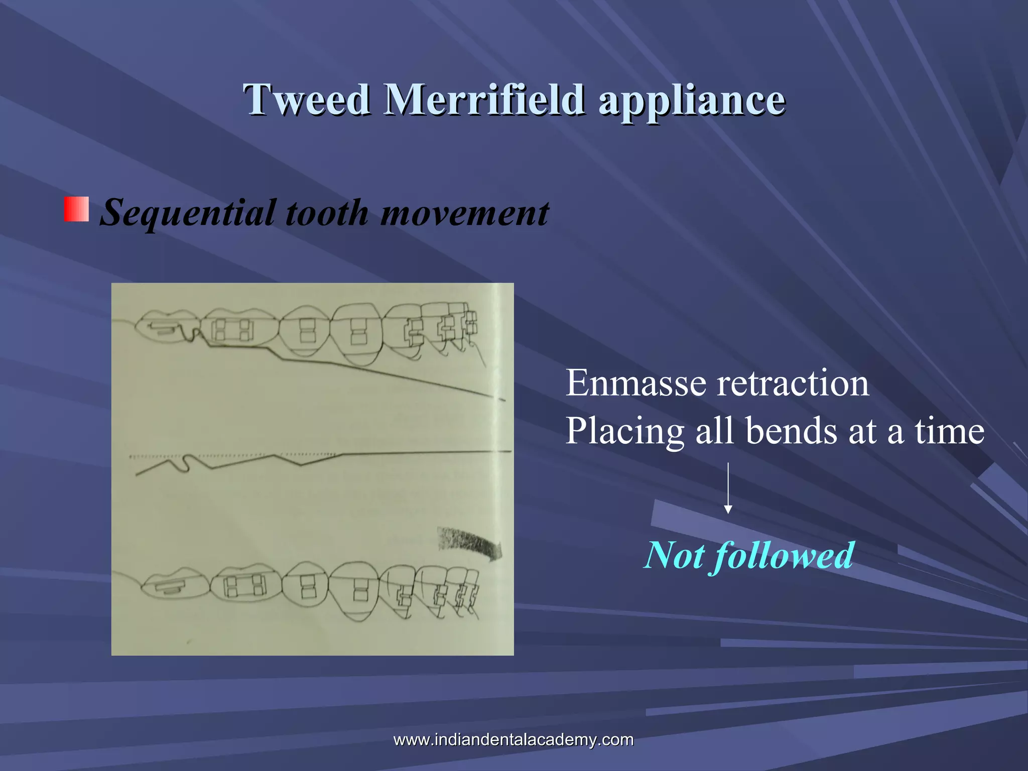 Tweed Merrifield appliance
Sequential tooth movement

Enmasse retraction
Placing all bends at a time
Not followed

www.indiandentalacademy.com

 