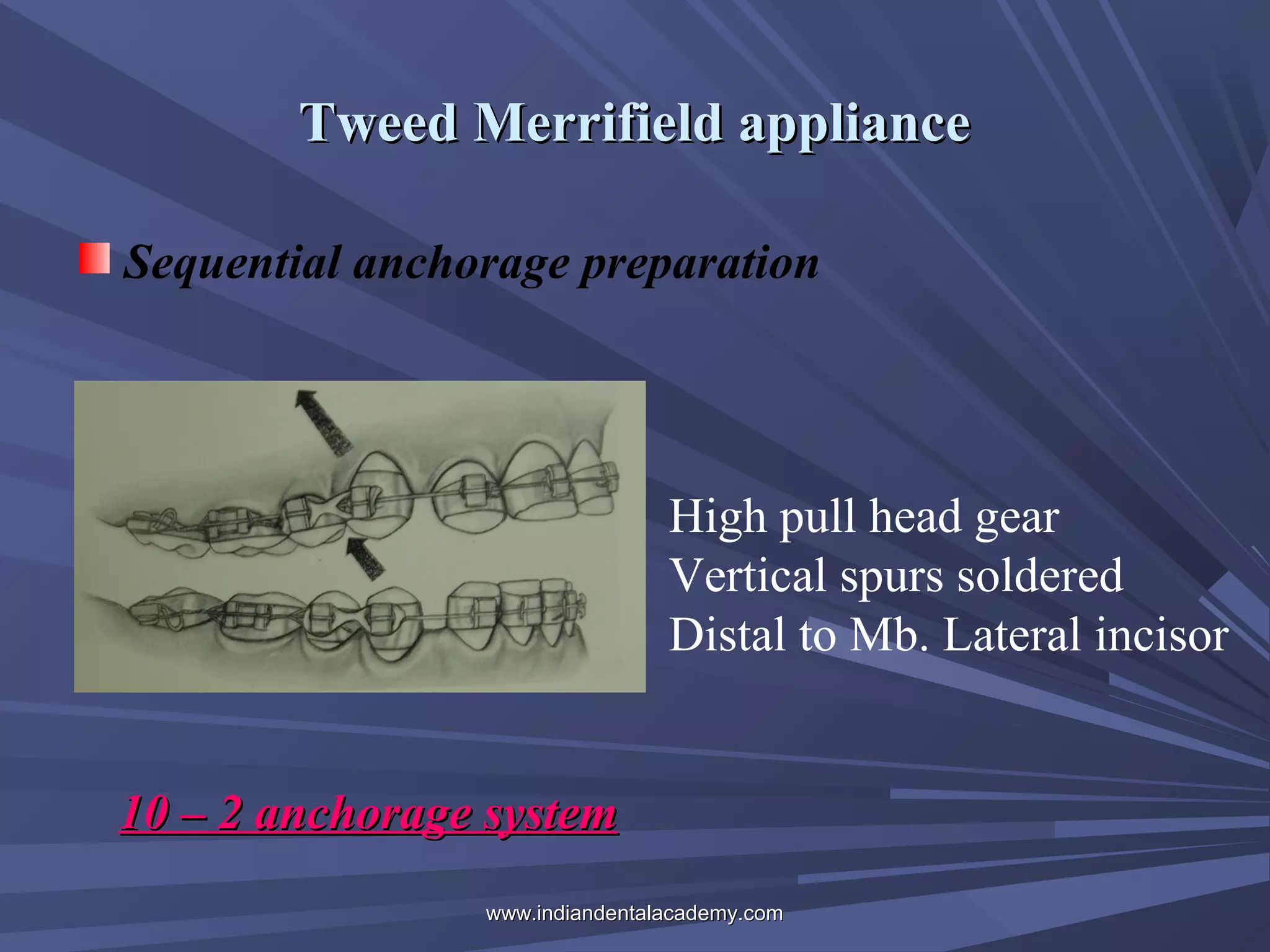 Tweed Merrifield appliance
Sequential anchorage preparation

High pull head gear
Vertical spurs soldered
Distal to Mb. Lateral incisor
10 – 2 anchorage system
www.indiandentalacademy.com

 