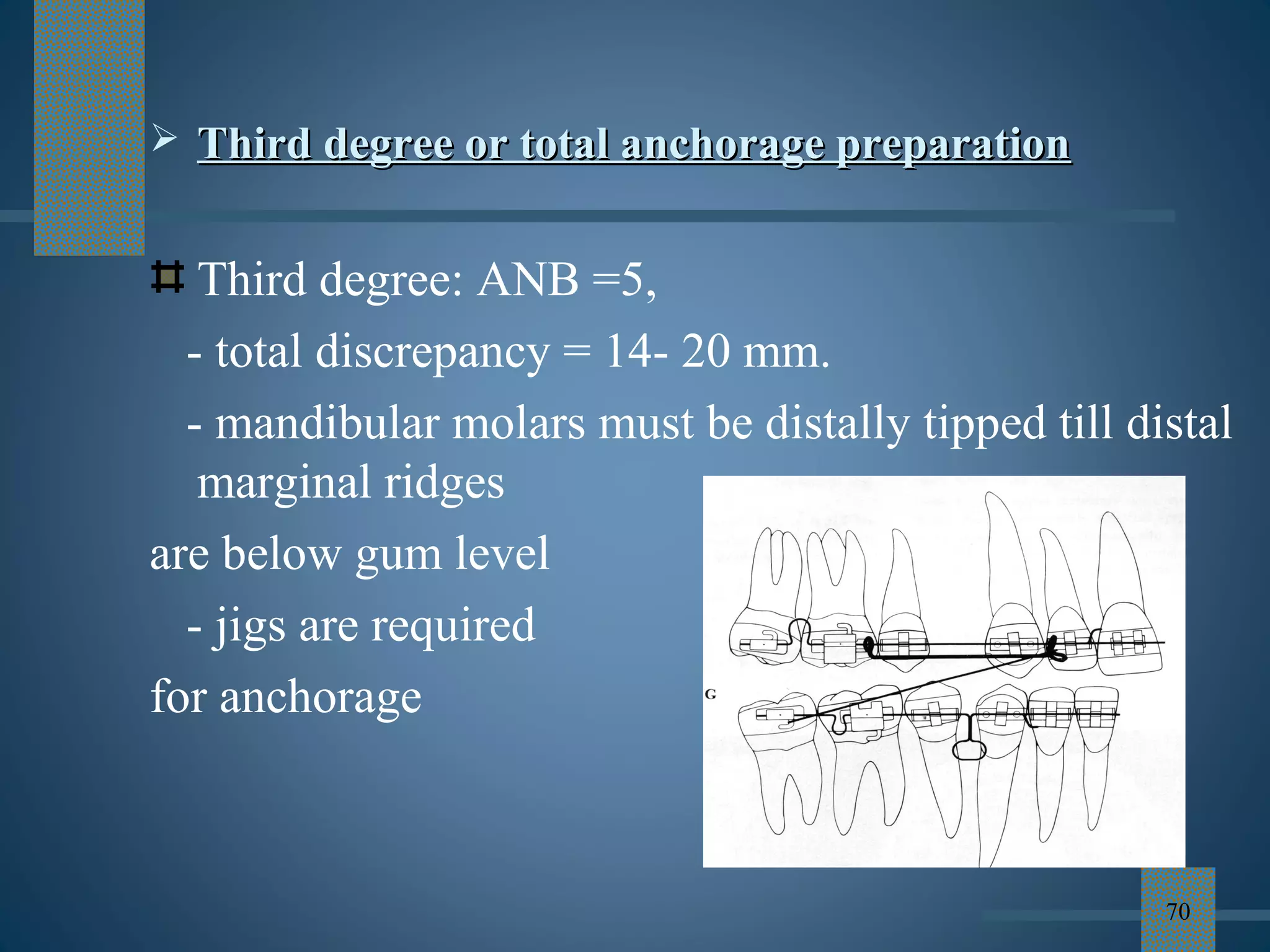 Anchorage in orthodontics ppt | PPT