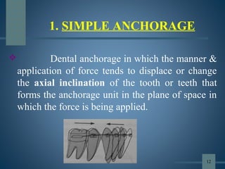 1. SIMPLE ANCHORAGE
 Dental anchorage in which the manner &
application of force tends to displace or change
the axial inclination of the tooth or teeth that
forms the anchorage unit in the plane of space in
which the force is being applied.
12
 