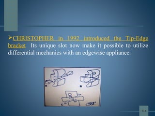 CHRISTOPHER in 1992 introduced the Tip-Edge
bracket Its unique slot now make it possible to utilize
differential mechanics with an edgewise appliance..
131
 